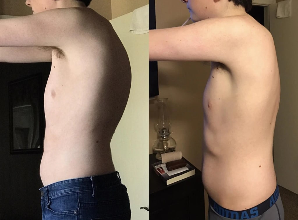 Instant Posture Corrector